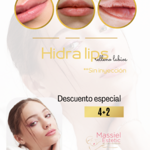 Hidra lips