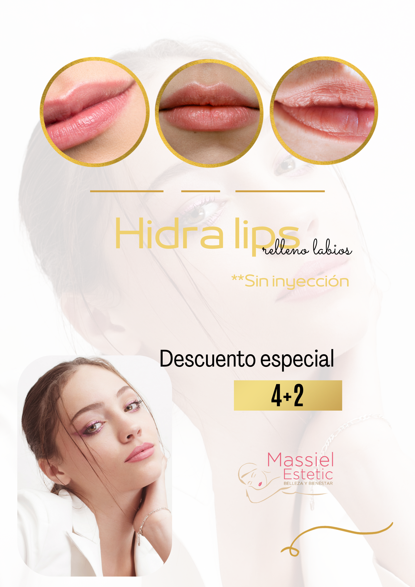 Hidra lips